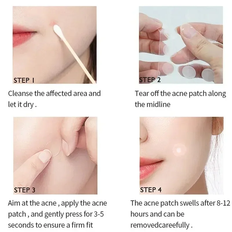 Invisible Acne Patches Hydrocolloid Patches Spots Marks Concealer Repair Removal Pimple Anti-Acne Sticker Waterproof 
Invisible Acne Patches Hydrocolloid Patches Spots Marks Concealer Repair Removal Pimple Anti-Acne Sticker Waterproof