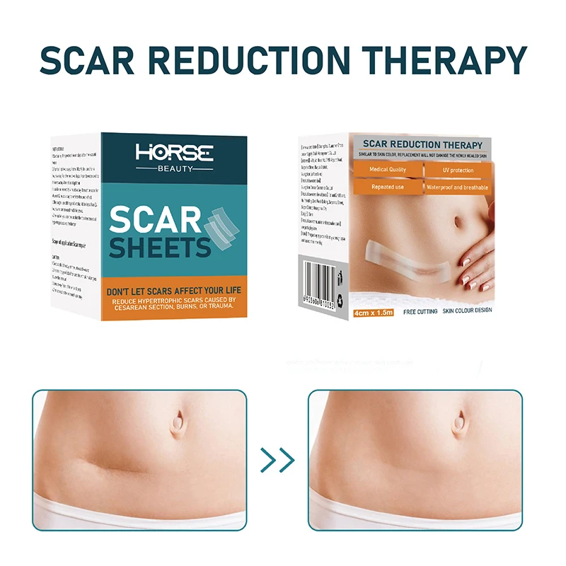 Силиконовый гель HORSE, силиконовый пластырь для ремонта ран, пластыри для шрамов, силиконовый пластырь для шрамов, инструменты для ухода за кожей 2025
Силиконовый гель HORSE, силиконовый пластырь для ремонта ран, пластыри для шрамов, силиконовый пластырь для шрамов, инструменты для ухода за кожей 2025