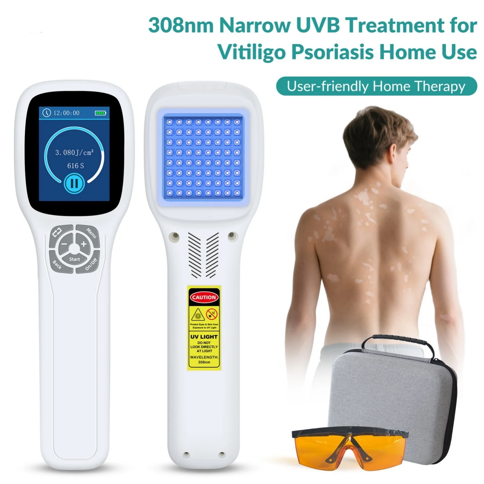 NEWNon Invasive 308nm Excimer UVB Light for Vitiligo Phototherapy Psoriasis Treatment Therapy at HomeGOOD
NEWNon Invasive 308nm Excimer UVB Light for Vitiligo Phototherapy Psoriasis Treatment Therapy at HomeGOOD