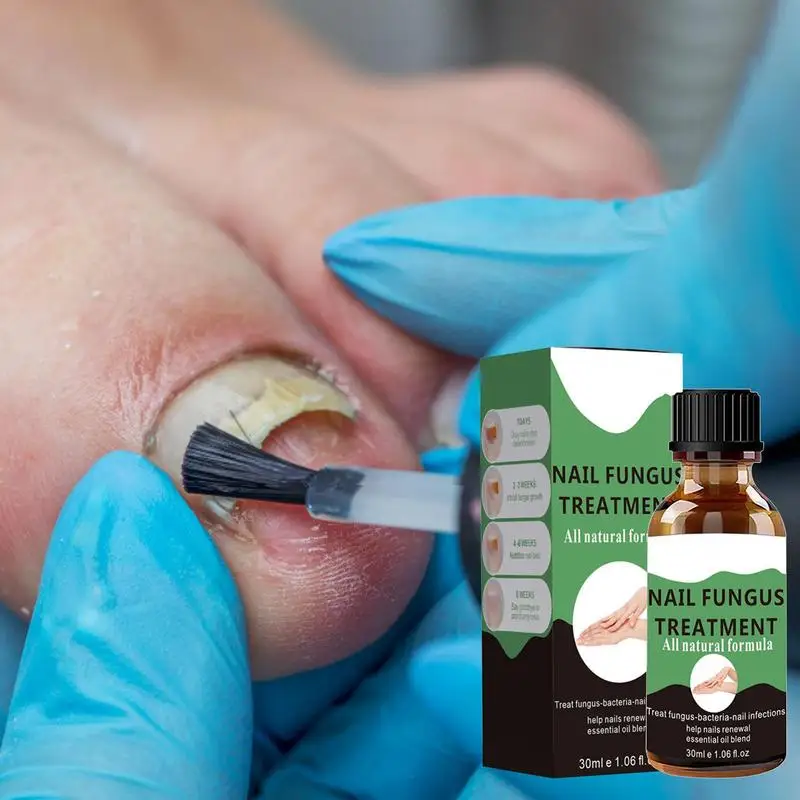 30ml Nail Repair Fluid Growth Nail Treat & Strengthener Nail Repair Treat For Toenail And Fingernail Extra Strong NailTreatment
30ml Nail Repair Fluid Growth Nail Treat & Strengthener Nail Repair Treat For Toenail And Fingernail Extra Strong NailTreatment