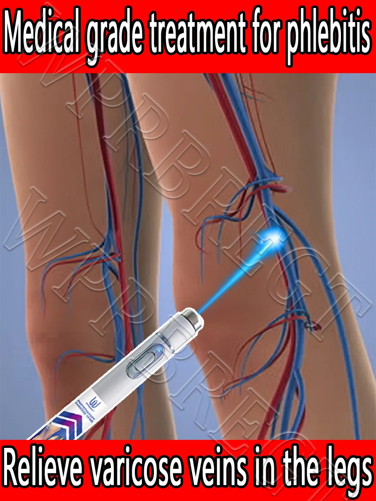 Upgraded varicose vein laser pen, medical grade treatment of phlebitis blood vessels, relief of varicose veins in the legs
Upgraded varicose vein laser pen, medical grade treatment of phlebitis blood vessels, relief of varicose veins in the legs