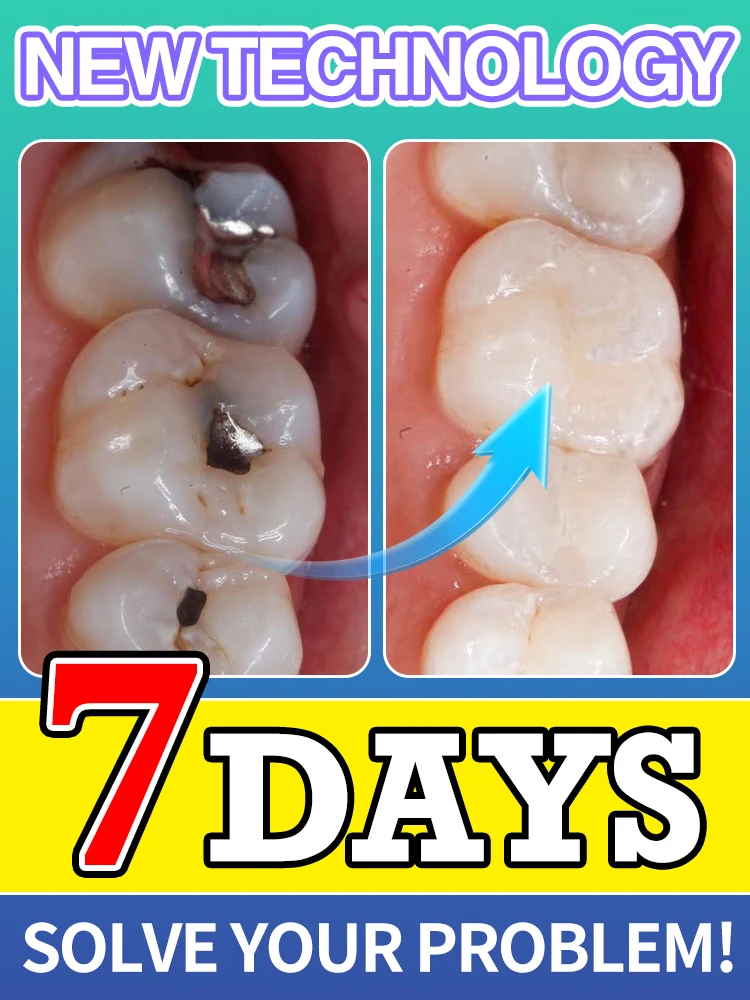 Probiotic tartar Removing Plaque Stains Yellow Teeth Stains Brighten Whiten Fresh Breath dental Hygiene Health Care
Probiotic tartar Removing Plaque Stains Yellow Teeth Stains Brighten Whiten Fresh Breath dental Hygiene Health Care