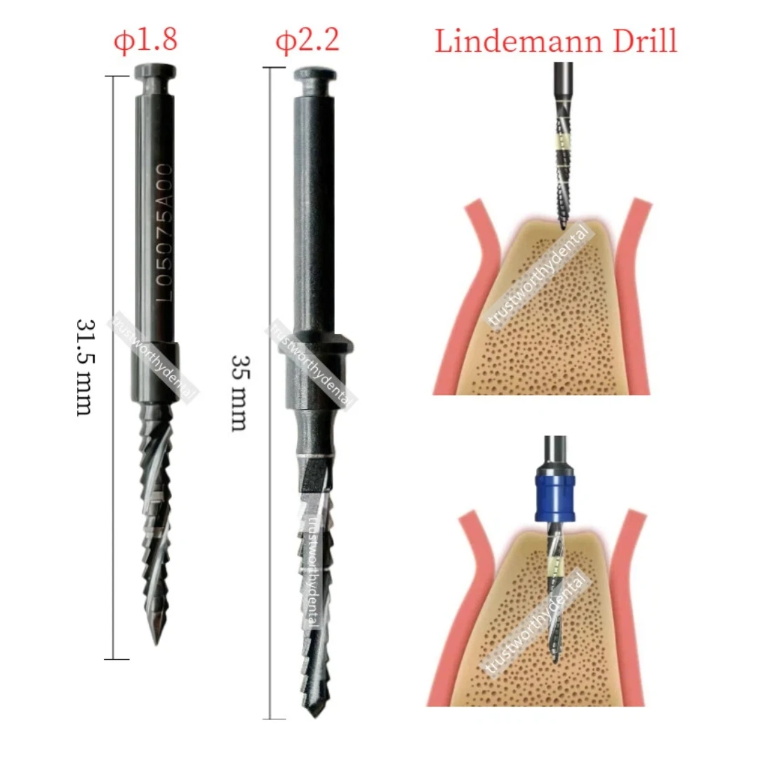Dental Lindemann Guide Drill XLD 2235 Cross Cutter Pilot Drill First Guide Stopper Pioneer Bone Leval Cut Blade Superline XLD 22
Dental Lindemann Guide Drill XLD 2235 Cross Cutter Pilot Drill First Guide Stopper Pioneer Bone Leval Cut Blade Superline XLD 22