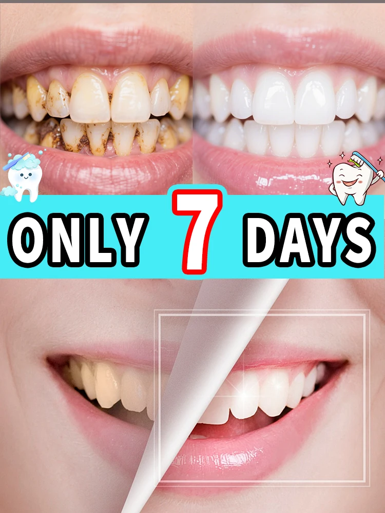 30g Hydroxyapatite Toothpaste,Gentle Mint,Breath Refreshing Whitening Toothpaste,Intensives Stain Removal Tooth Paste,Oral Care
30g Hydroxyapatite Toothpaste,Gentle Mint,Breath Refreshing Whitening Toothpaste,Intensives Stain Removal Tooth Paste,Oral Care