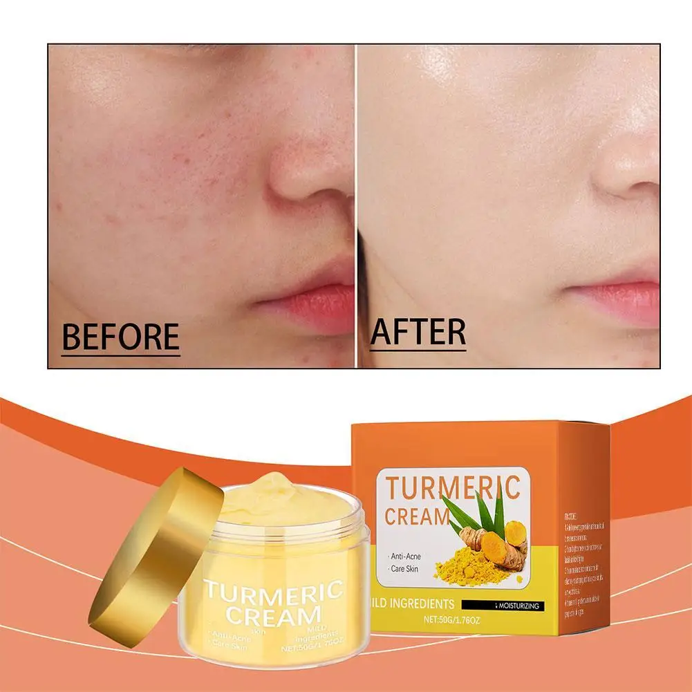 50g Turmeric VC Face Cream Deeply Moisturizes And Desalinates Skin Leaving Skin Fresh Non Greasy Smooth Skin Care
50g Turmeric VC Face Cream Deeply Moisturizes And Desalinates Skin Leaving Skin Fresh Non Greasy Smooth Skin Care