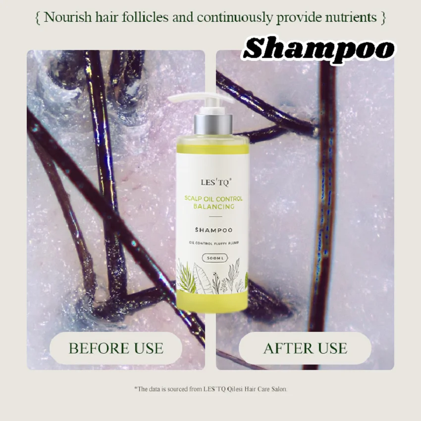 LES'TQ Шампунь для контроля жирности | Балансовое масло и увлажнение, придание себовом производства, глубоко очищает кожу головы, длительная свежесть 
LES'TQ Шампунь для контроля жирности | Балансовое масло и увлажнение, придание себовом производства, глубоко очищает кожу головы, длительная свежесть