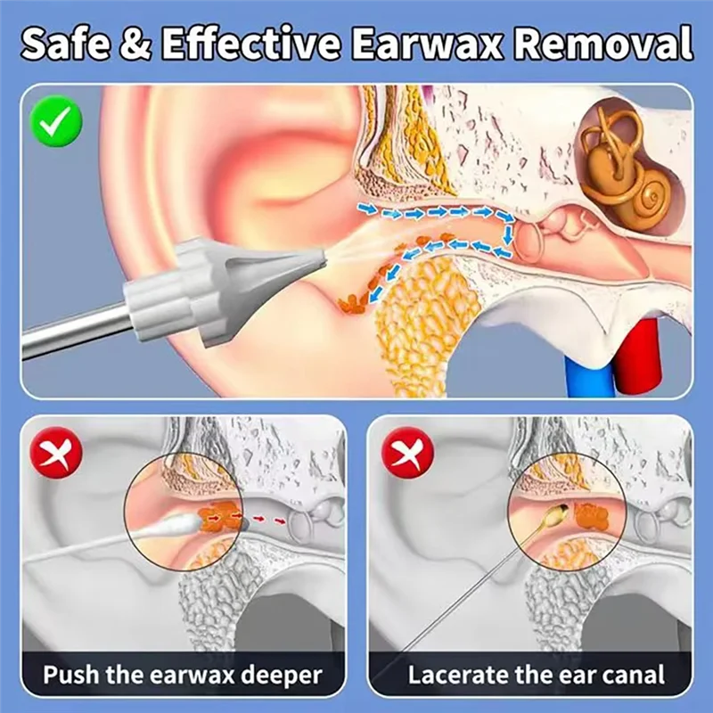 SOFT-Ear Wax Removal Kit Smart Ear Cleaner LCD Electric Ear Cleaner With 250Ml Water Tank
SOFT-Ear Wax Removal Kit Smart Ear Cleaner LCD Electric Ear Cleaner With 250Ml Water Tank