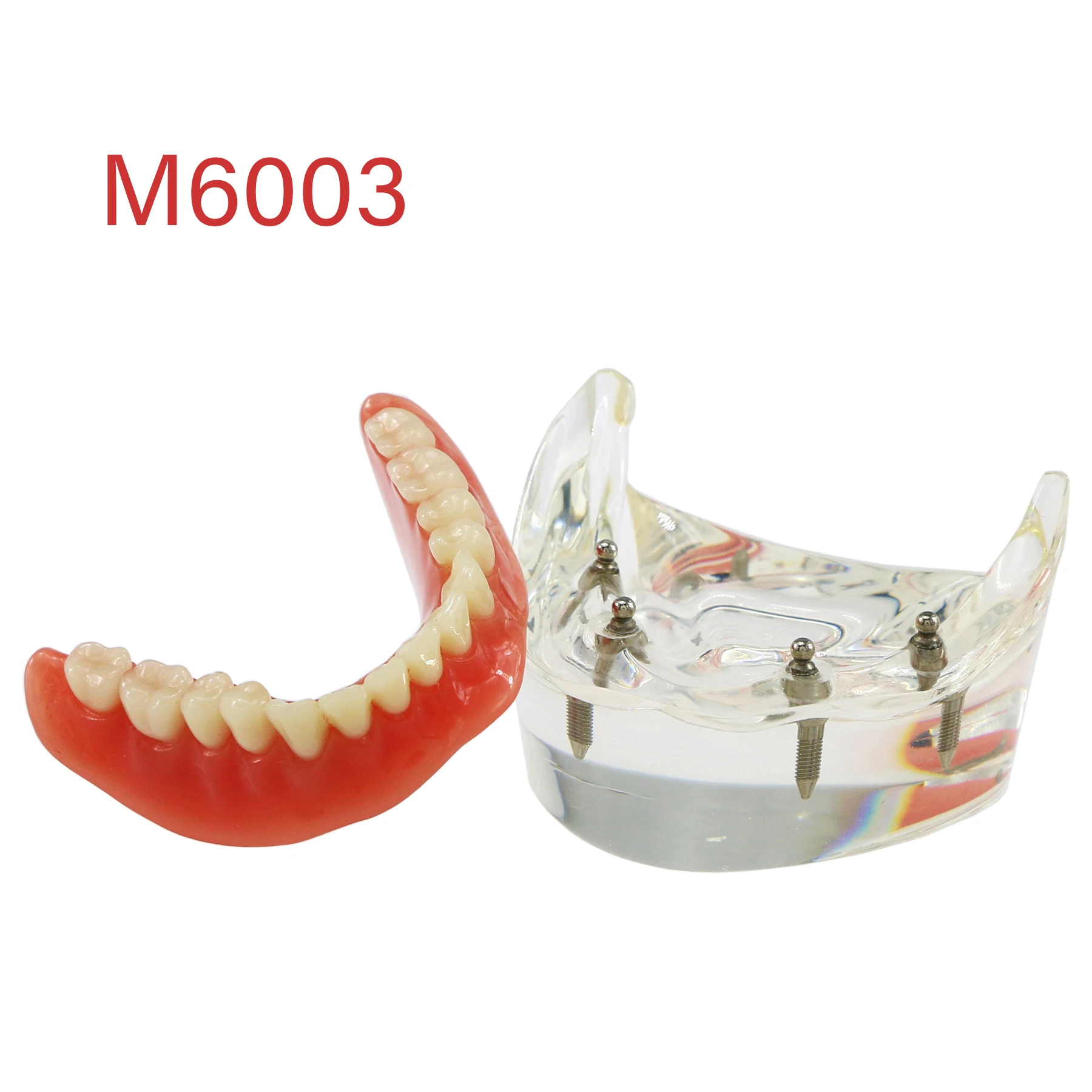 Зубной имплантат Overdenture Модель зубов Демонстрационная реставрация 4-имплантаты Нижний M6003
Зубной имплантат Overdenture Модель зубов Демонстрационная реставрация 4-имплантаты Нижний M6003