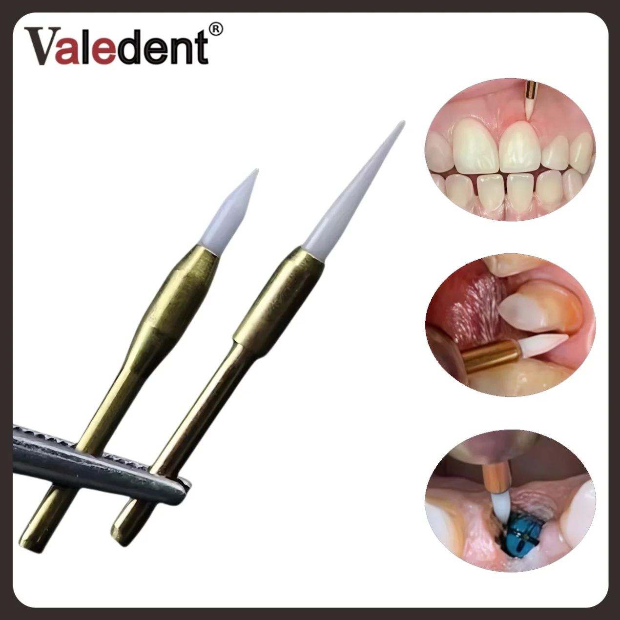 Dental Dentistry Soft Tissue Burs Gingiva Trimmer Implant Surgical Ceramic Tool for Teeth Cleaning and Whitening
Dental Dentistry Soft Tissue Burs Gingiva Trimmer Implant Surgical Ceramic Tool for Teeth Cleaning and Whitening