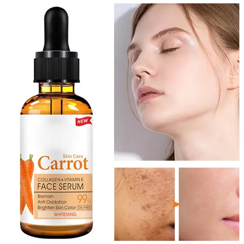 Face Serum Moisturizing Uniform Skin Tone Firming Lifting Reduce Skin Dullness Deep Nourishment Repair Skin Care 30ml
Face Serum Moisturizing Uniform Skin Tone Firming Lifting Reduce Skin Dullness Deep Nourishment Repair Skin Care 30ml