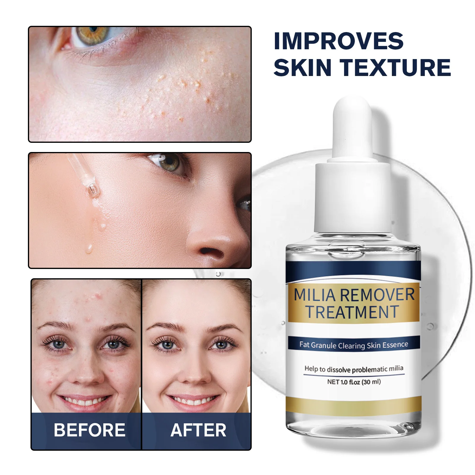 Milia Remover Essence Treatment Fat Granule Clearing Skin Hyaluronic Acid Deep Hydration and Gentle Exfoliation Hydrates Smooths
Milia Remover Essence Treatment Fat Granule Clearing Skin Hyaluronic Acid Deep Hydration and Gentle Exfoliation Hydrates Smooths