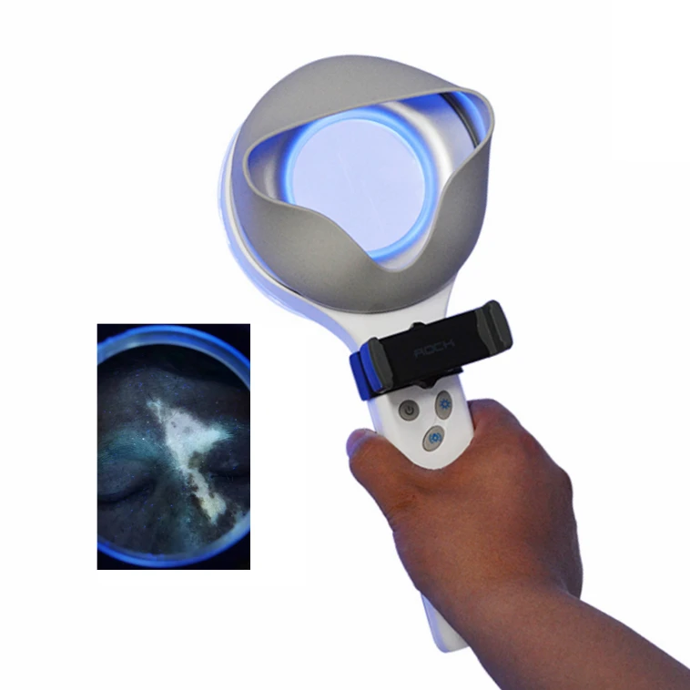 KN- 9000B Combined Light UVA and White LED Woods Lamp for in Analysis Medical Woods Lamp for Sn Disease test
KN- 9000B Combined Light UVA and White LED Woods Lamp for in Analysis Medical Woods Lamp for Sn Disease test