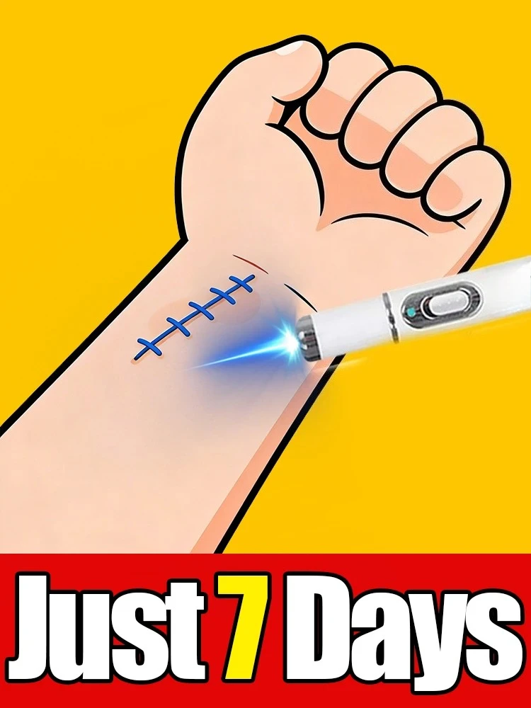 free shipping, blue light pen solve scar,scar care tools, unisex Help people with scars solve their problems
free shipping, blue light pen solve scar,scar care tools, unisex Help people with scars solve their problems