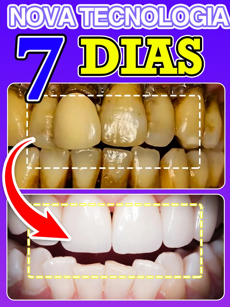 Tartar Control Formula for Teeth Whitening and Fresh Breath
Tartar Control Formula for Teeth Whitening and Fresh Breath