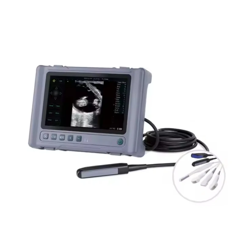 8 Inch Large Screen Waterproof Veterinary Handheld Ultrasound Scanner Machine Reusable Convex Probe for Horse Cattle Diagnosis
8 Inch Large Screen Waterproof Veterinary Handheld Ultrasound Scanner Machine Reusable Convex Probe for Horse Cattle Diagnosis