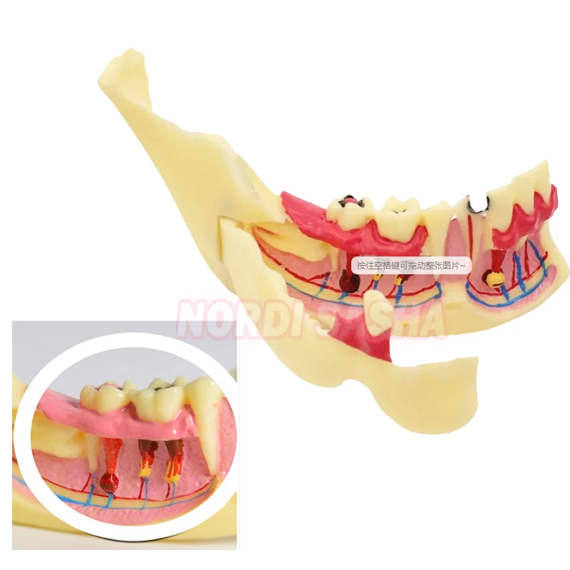 M4014 Dental Endodontic Treatment Model Right Side Mandible Tissue Anatomical Model Anatomy Of Gums Teeth Models Studying
M4014 Dental Endodontic Treatment Model Right Side Mandible Tissue Anatomical Model Anatomy Of Gums Teeth Models Studying