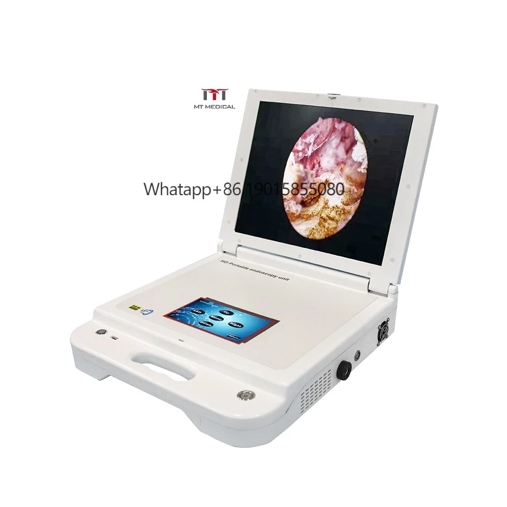 MT MEDICAL Portable Endoscope for Endoscopy USB HDMI HD 1080P Endoscope System with Light Source
MT MEDICAL Portable Endoscope for Endoscopy USB HDMI HD 1080P Endoscope System with Light Source