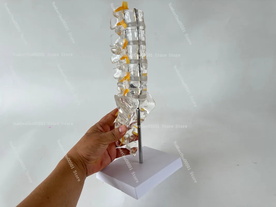 30250119 Lumbar Spine Model with Tailbone Transparent Intervertebral Disc Spinal Nerve Sacrum for Orthopedic 3D Teaching
30250119 Lumbar Spine Model with Tailbone Transparent Intervertebral Disc Spinal Nerve Sacrum for Orthopedic 3D Teaching