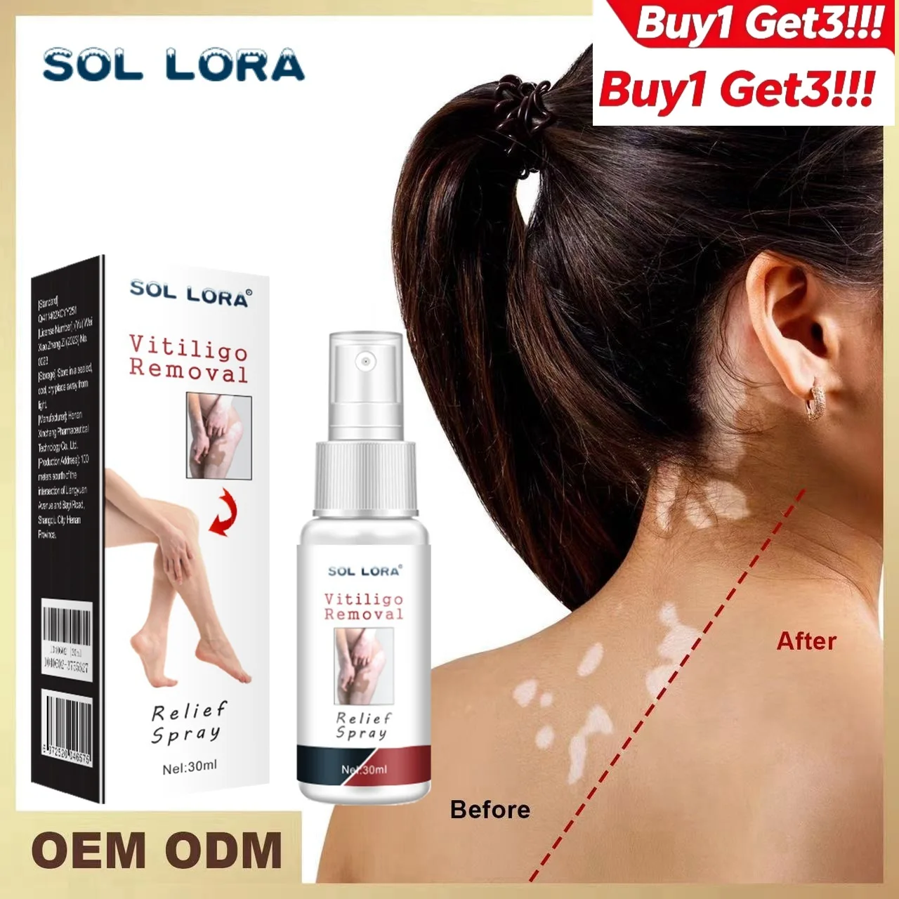 Buy 1 Get 3 Vitiligo Clear Care Spray Psoralea Skin Repair for White Spots & Tinea Versicolor
Buy 1 Get 3 Vitiligo Clear Care Spray Psoralea Skin Repair for White Spots & Tinea Versicolor