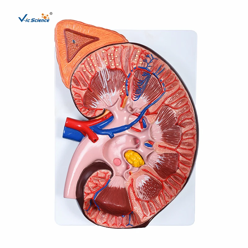 Enlarged Kidney Model 1 Part Anatomy Kidney Model Medical Science Teaching for Students
Enlarged Kidney Model 1 Part Anatomy Kidney Model Medical Science Teaching for Students