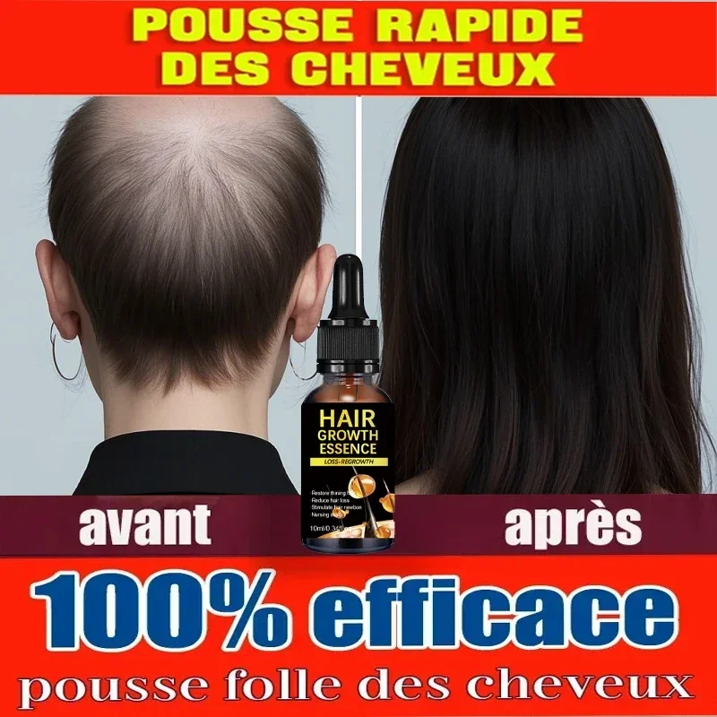 Hair Growth Essential Loss Regrowth Treatment Strengthens Hair Nourishes Scalp Light Weight Non Greasy Improve Scalp Circulation
Hair Growth Essential Loss Regrowth Treatment Strengthens Hair Nourishes Scalp Light Weight Non Greasy Improve Scalp Circulation