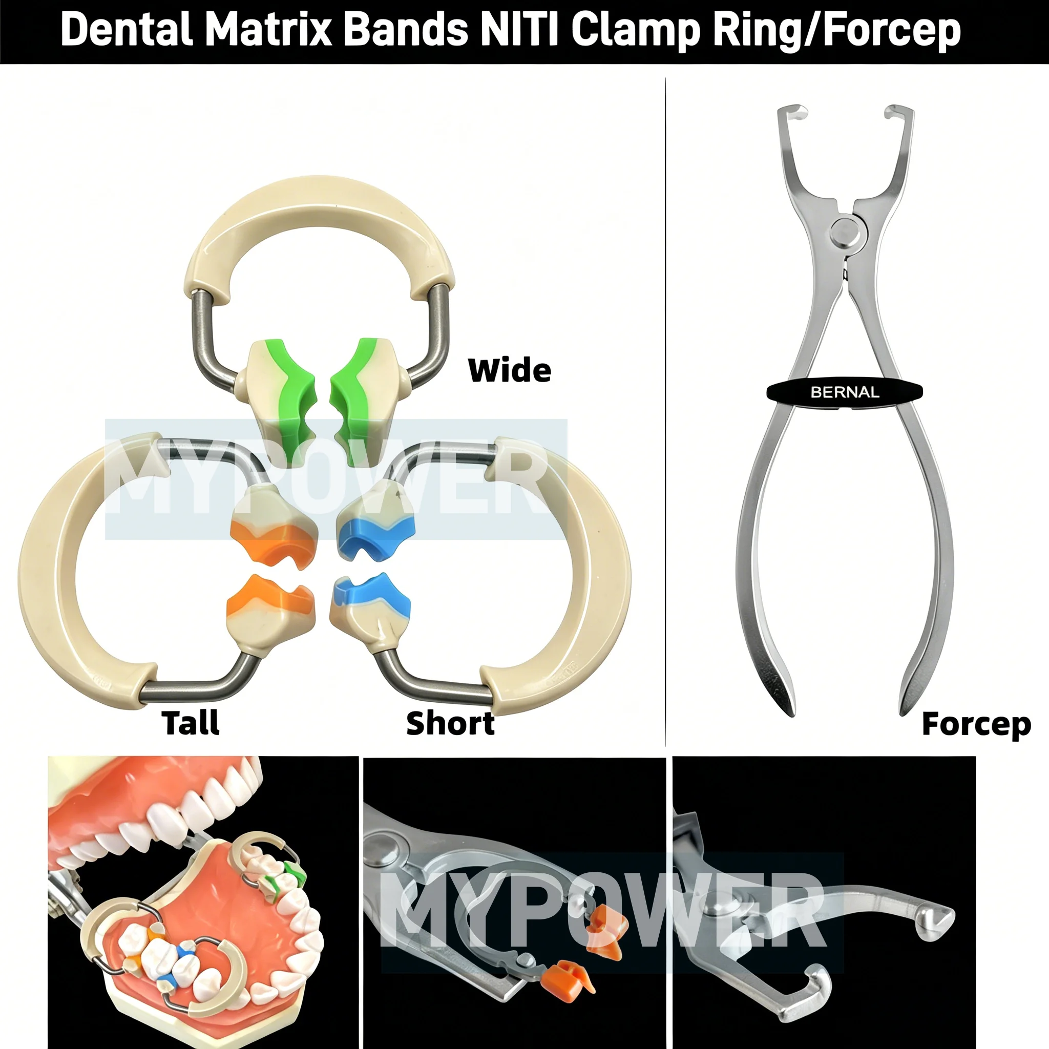NITI Metal Dental Matrix Bands 3D Premier Contoured Matrix System with Clamp Ring & Placement Forcep Fits Garrison
NITI Metal Dental Matrix Bands 3D Premier Contoured Matrix System with Clamp Ring & Placement Forcep Fits Garrison