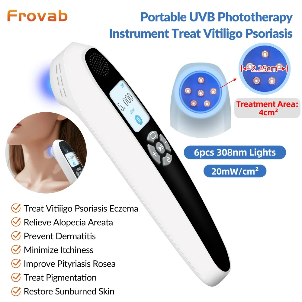 Precision 308nm Excimer Therapy Device 6 Diodes Targeted Ultraviolet Light Treatment for Eczema Dermatitis Vitiligo White Spots
Precision 308nm Excimer Therapy Device 6 Diodes Targeted Ultraviolet Light Treatment for Eczema Dermatitis Vitiligo White Spots