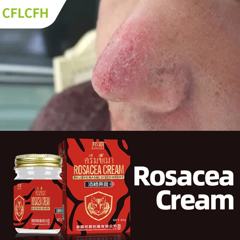 Rosacea Treatment Cream Red Nose Repair Face Shrink Pores Blackhead Acne Remover Anti Nose Mites Skin Care Thailand Formula
Rosacea Treatment Cream Red Nose Repair Face Shrink Pores Blackhead Acne Remover Anti Nose Mites Skin Care Thailand Formula