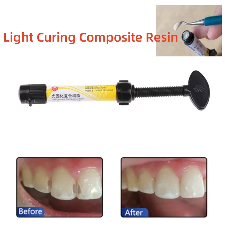 Universal Dental Light Curing Composite Resin Dental Filling Resin A2/Dental orthodontic Light Curing Adhesive Composite Resin
Universal Dental Light Curing Composite Resin Dental Filling Resin A2/Dental orthodontic Light Curing Adhesive Composite Resin