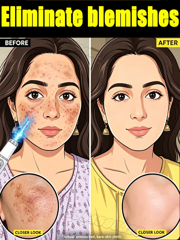 Suitable for everyone, it can help remove dirt from the face.
Suitable for everyone, it can help remove dirt from the face.
