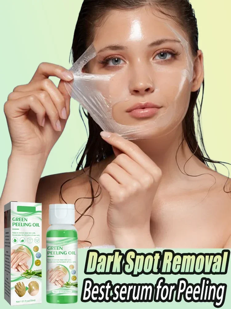 Skin Exfoliation Green Oil Elbow Joint Peeling Whitening Cream Chicken Skin Melanin Removal Underarm Dark Brighten Body Care
Skin Exfoliation Green Oil Elbow Joint Peeling Whitening Cream Chicken Skin Melanin Removal Underarm Dark Brighten Body Care