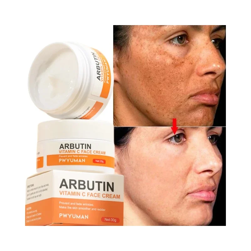 Powerful Whiten Freckle Cream Fast Remove Melasma Melanin Correcter Anti-Pigmentation Dark Spot Fade Improve Dullness Skin Care
Powerful Whiten Freckle Cream Fast Remove Melasma Melanin Correcter Anti-Pigmentation Dark Spot Fade Improve Dullness Skin Care