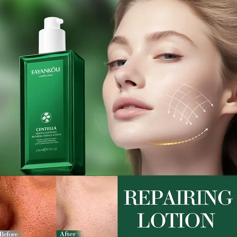 105g Centella Asian Facial Serum Centella Soothing Moisturizing Repair Skin Lotion Korean Skin Care Facial Products For Women
105g Centella Asian Facial Serum Centella Soothing Moisturizing Repair Skin Lotion Korean Skin Care Facial Products For Women