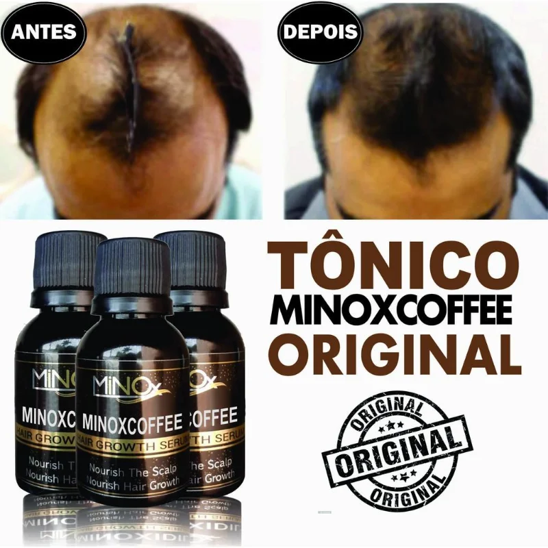 New Arrivals 2022 Hair Lotion Hair Tonic Assists In The Strengthening of The Beard and Hair for Man
New Arrivals 2022 Hair Lotion Hair Tonic Assists In The Strengthening of The Beard and Hair for Man