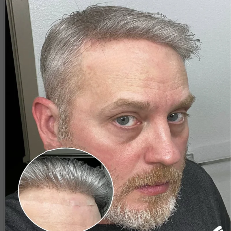 Ultra Thin Skin 0.02mm 80-100%Density Men Toupee Brown Black 1B65 Super Undetectable Natural Hairline Prosthes Human Hair System
Ultra Thin Skin 0.02mm 80-100%Density Men Toupee Brown Black 1B65 Super Undetectable Natural Hairline Prosthes Human Hair System