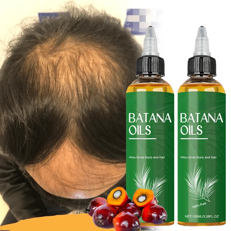 2Pcs Batana Hair Growth Essential Oil Dense Strengthening Hair Prevent Loss Improve Hair Dryness Split Moisturizing Shiny Hair 
2Pcs Batana Hair Growth Essential Oil Dense Strengthening Hair Prevent Loss Improve Hair Dryness Split Moisturizing Shiny Hair