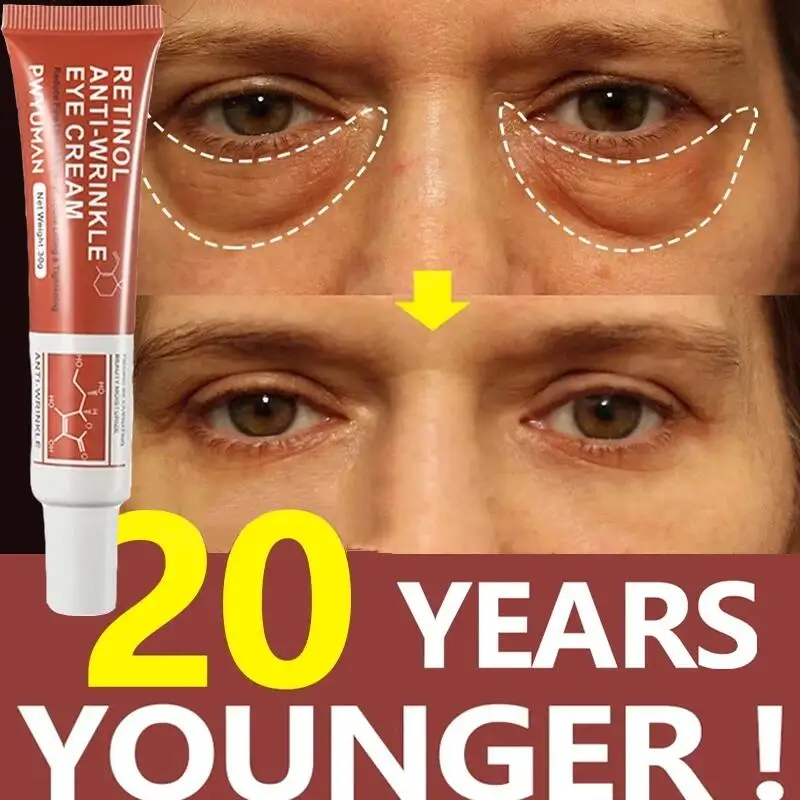 Retinol Anti-Wrinkle Eye Cream Remove Eye Bags Dark Circles Anti Aging Lifting Firming Whitening Moisturizing Brighten Skin Care
Retinol Anti-Wrinkle Eye Cream Remove Eye Bags Dark Circles Anti Aging Lifting Firming Whitening Moisturizing Brighten Skin Care