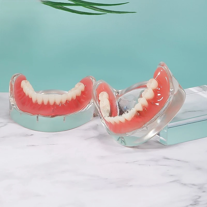 Dentistry Dental Overdenture Teeth Model Lower Tooth Implant for Researching Medical Dentist Teaching Studying Removable Tools
Dentistry Dental Overdenture Teeth Model Lower Tooth Implant for Researching Medical Dentist Teaching Studying Removable Tools