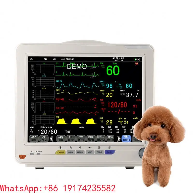 Multi-Para-meter Vet-erinary M-oni-tor Vet Bl-ood Pre-ssure Mon-itor Multi - Param-eter Mo-nit-or for Dogs and Cats
Multi-Para-meter Vet-erinary M-oni-tor Vet Bl-ood Pre-ssure Mon-itor Multi - Param-eter Mo-nit-or for Dogs and Cats