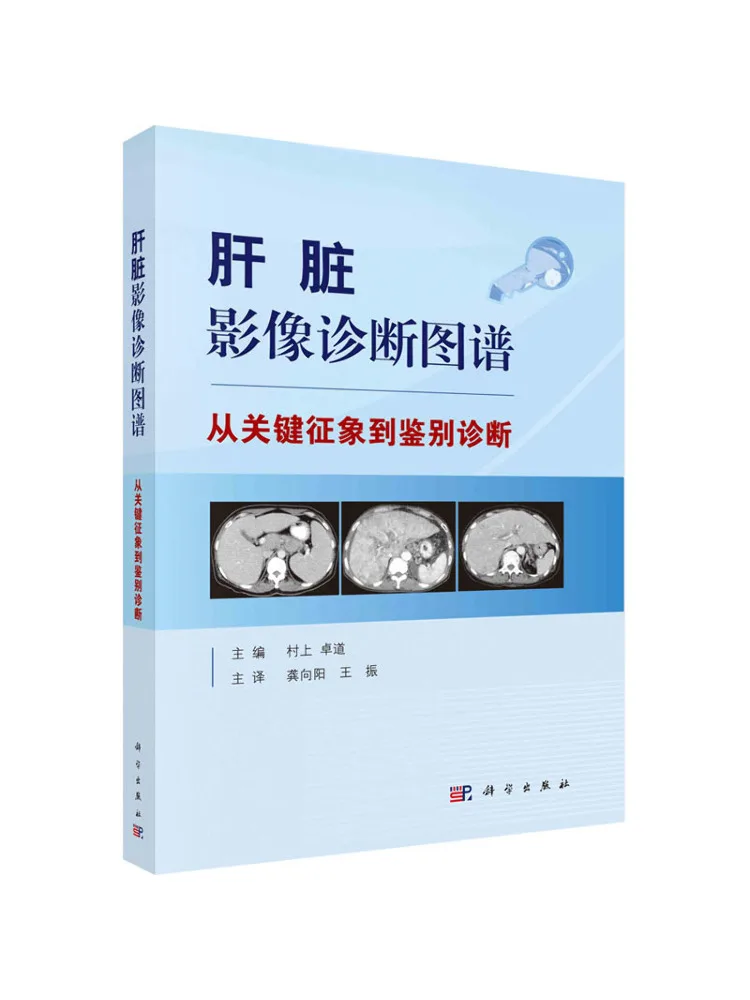 Book-Winshare Liver Imaging Diagnostic Atlas From Key Objects To Identification Diagnosis
Book-Winshare Liver Imaging Diagnostic Atlas From Key Objects To Identification Diagnosis