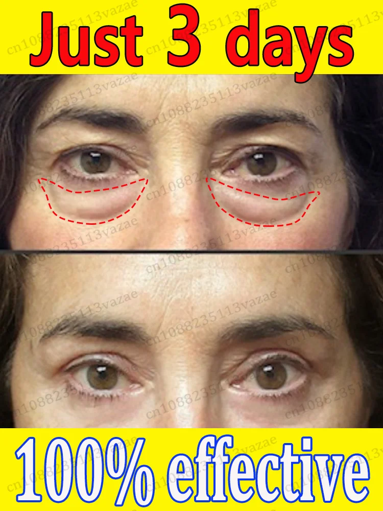 оставайся подогревом эссенции для глаз, сохраните свои глаза навсегда молодые
оставайся подогревом эссенции для глаз, сохраните свои глаза навсегда молодые