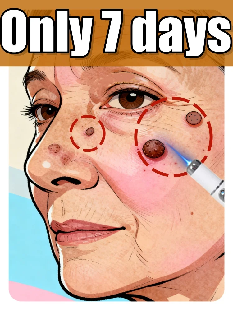 2025 Home-Use Technology for Healthy Warts: Caring for the Whole Family's Health
2025 Home-Use Technology for Healthy Warts: Caring for the Whole Family's Health