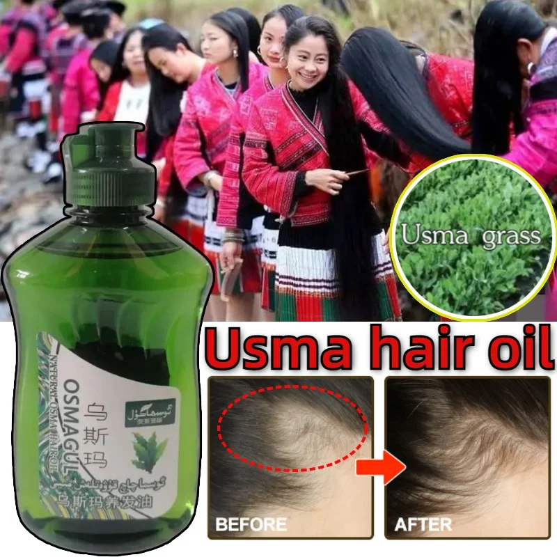 Usma Grass Extract Hair Care Oil Care Nutrition Promote Hair Growth Repair Damaged Follicles 200ML
Usma Grass Extract Hair Care Oil Care Nutrition Promote Hair Growth Repair Damaged Follicles 200ML