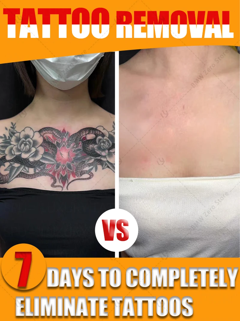 For the removal of colored permanent makeup tattoos, fast tattoo removal cream, text tattoo removal, pattern tattoo removal
For the removal of colored permanent makeup tattoos, fast tattoo removal cream, text tattoo removal, pattern tattoo removal