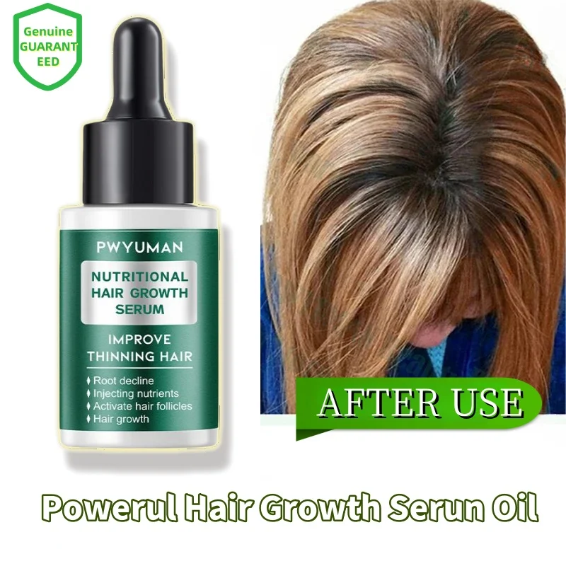 Powerful Hair Growth Serum Oil Repair Nourish Hair Root Regrowth Anti Hair Loss Treatment Essential Oils Men Women Hair Care
Powerful Hair Growth Serum Oil Repair Nourish Hair Root Regrowth Anti Hair Loss Treatment Essential Oils Men Women Hair Care