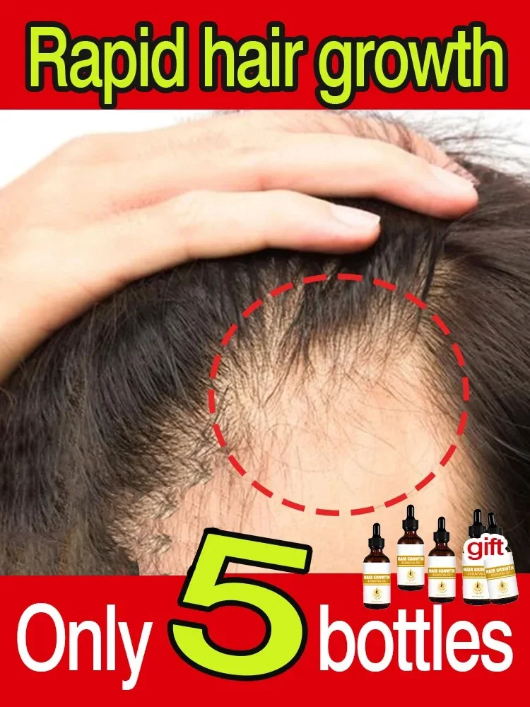 Fast Hair Growth Oil for Men Biotin Fast Treatment Baldness Serum Hair Growth Oil for Black Women
Fast Hair Growth Oil for Men Biotin Fast Treatment Baldness Serum Hair Growth Oil for Black Women