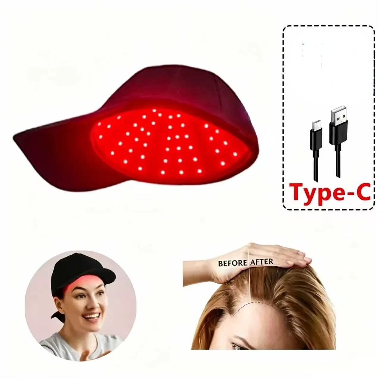 82 Laser Diodes Hair Growth Cap 650nm 630nm Low Level Light Therapy Hat for Androgenetic Alopecia Receding Hairline Scalp Care
82 Laser Diodes Hair Growth Cap 650nm 630nm Low Level Light Therapy Hat for Androgenetic Alopecia Receding Hairline Scalp Care