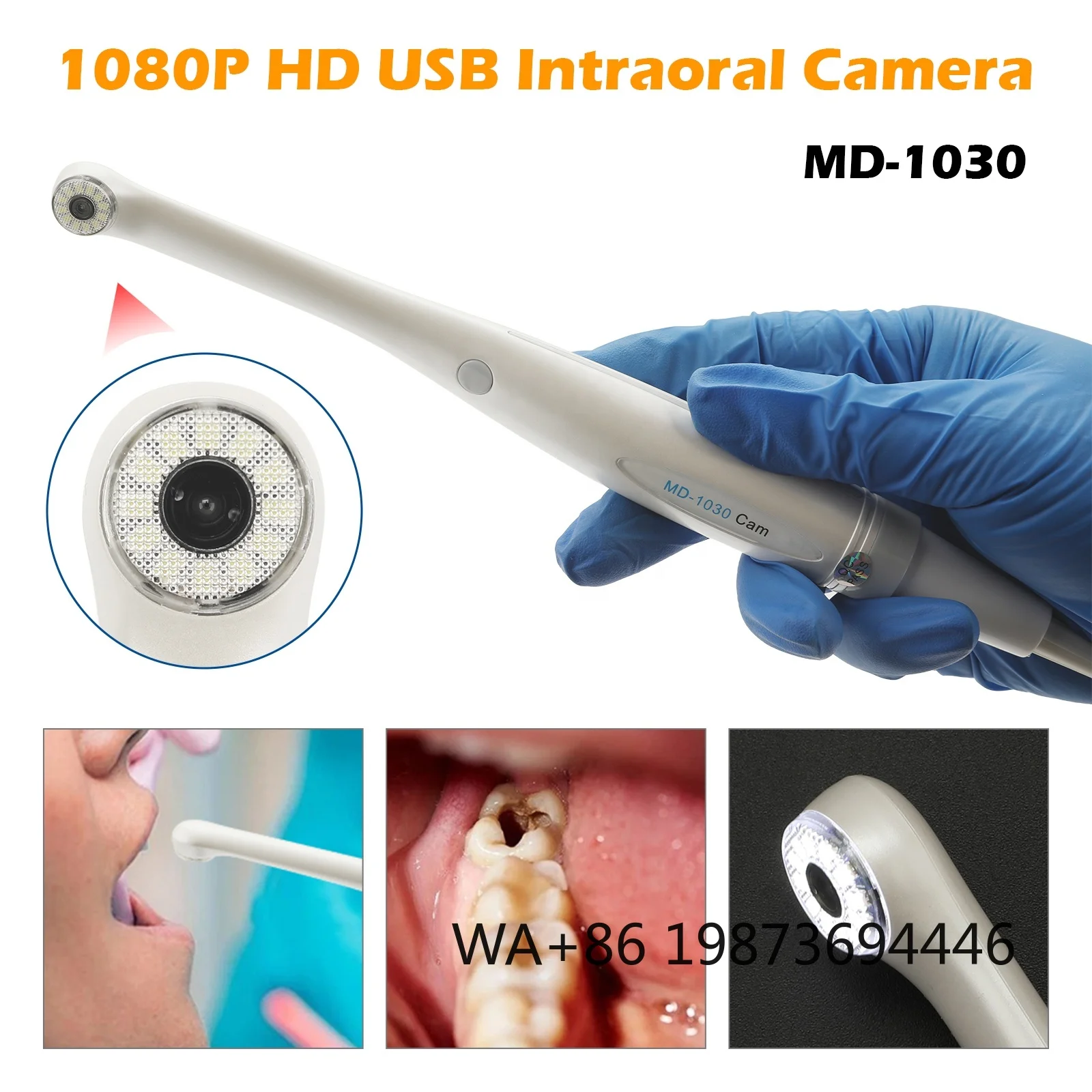 1080P HD USB Intraoral 1/3" CMOS White Light Endoscope for Precision Dental Examination
1080P HD USB Intraoral 1/3" CMOS White Light Endoscope for Precision Dental Examination