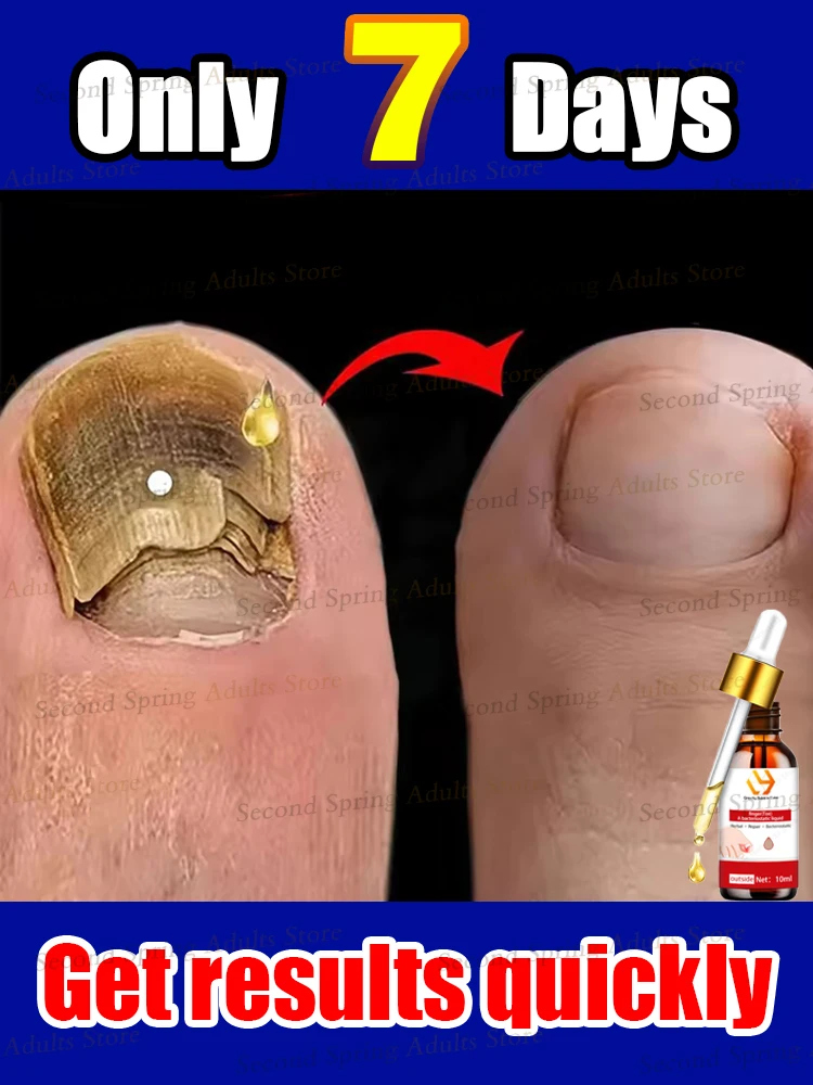Highly effective repair of Foot fingernail 
Highly effective repair of Foot fingernail