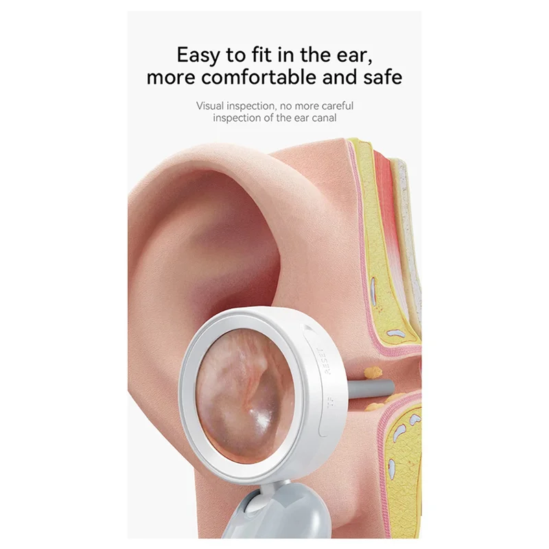 【Hot Selling】2X Visual Ear Otoscope 1.38 Inch IPS Wireless Endoscope 1080P HD Camera Ear Wax Clean Take Picture Video Ear Inspec
【Hot Selling】2X Visual Ear Otoscope 1.38 Inch IPS Wireless Endoscope 1080P HD Camera Ear Wax Clean Take Picture Video Ear Inspec